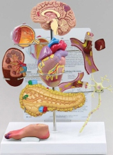 Type II Diabetes Pharmaceutical and Anatomical Model Gifts